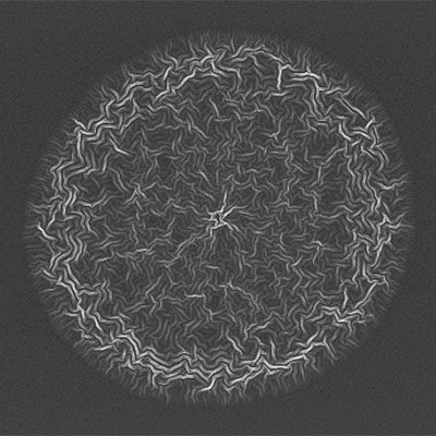 Best Electron Micrograph -  Matteo Castellani , Alessandro Buzzi -MIT
