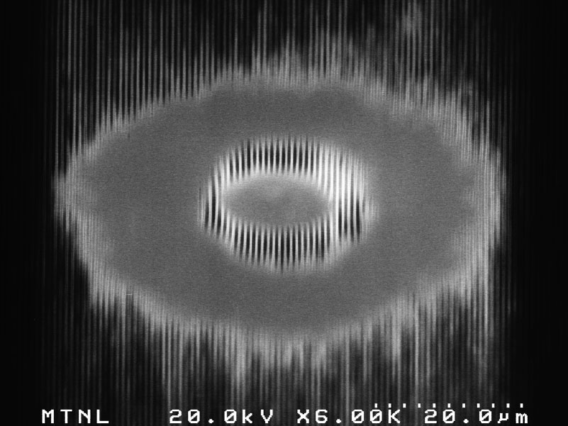 2025 Grand Prize Micrograph